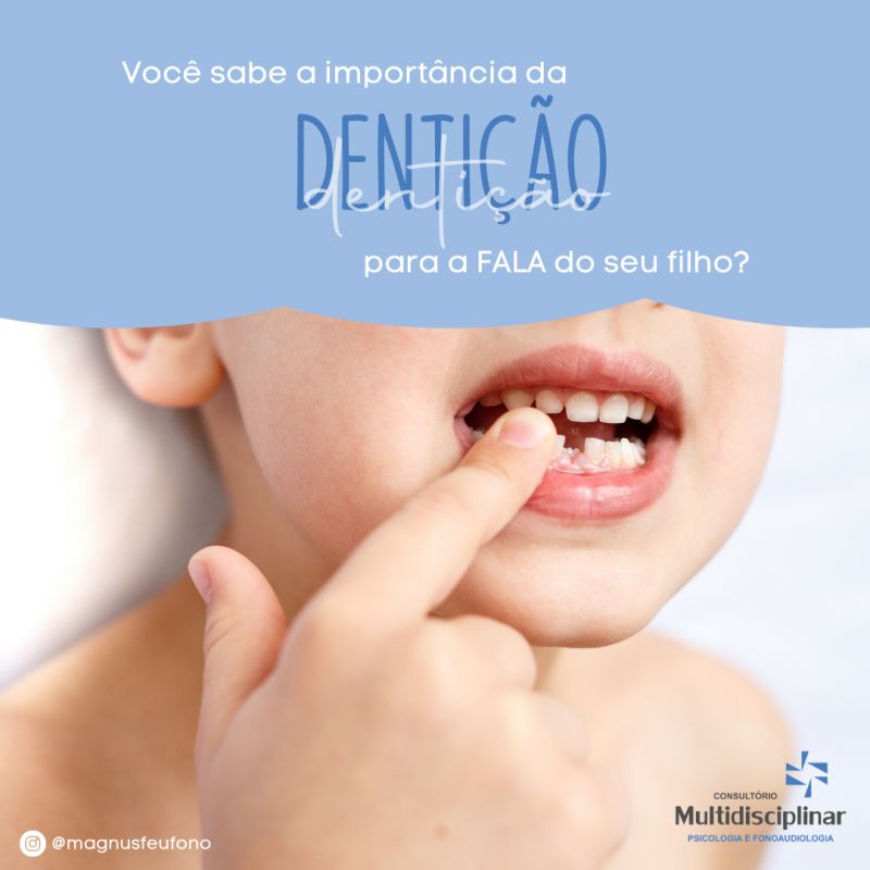 Dentição e Fala